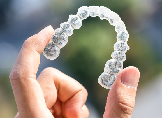 ClearCorrect clear aligner